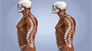 腰间盘突出的源头已找到，久坐排末位，第一名很多人天天都在做！.gif