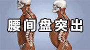 腰间盘突出的源头已找到，久坐排末位，第一名很多人天天都在做
